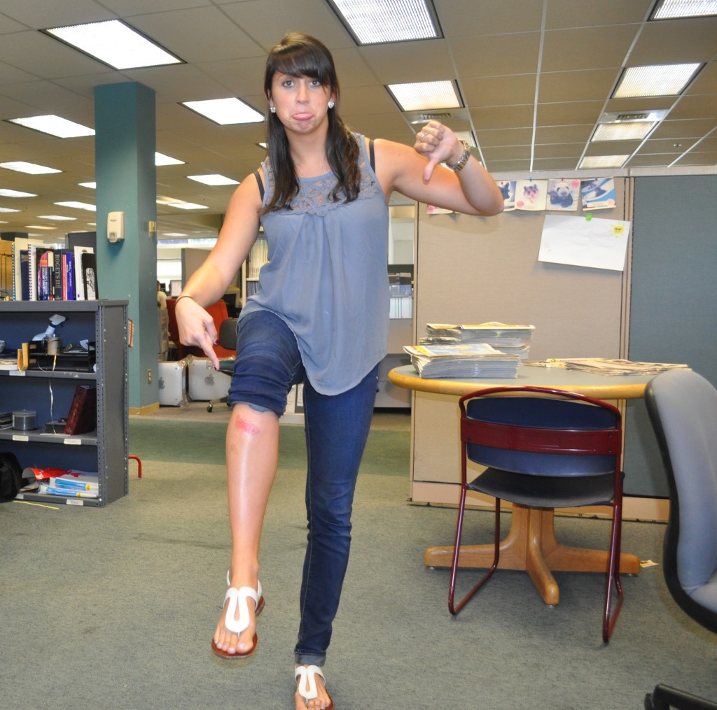 Who says advertising isn’t a contact sport? Insider sales wiz Alexandra Chaisson sliced up her knee walking the mean streets of Concord recently, but it didn’t slow her down. This is what we are willing to do for you, readers.
