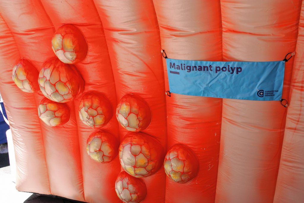 Ever seen a super-sized depiction of a malignant colon polyp? Luckily, this exact attraction was at Market Days, which was a hit with the kids despite the odd nature of the thing.  JON BODELL / Insider staff